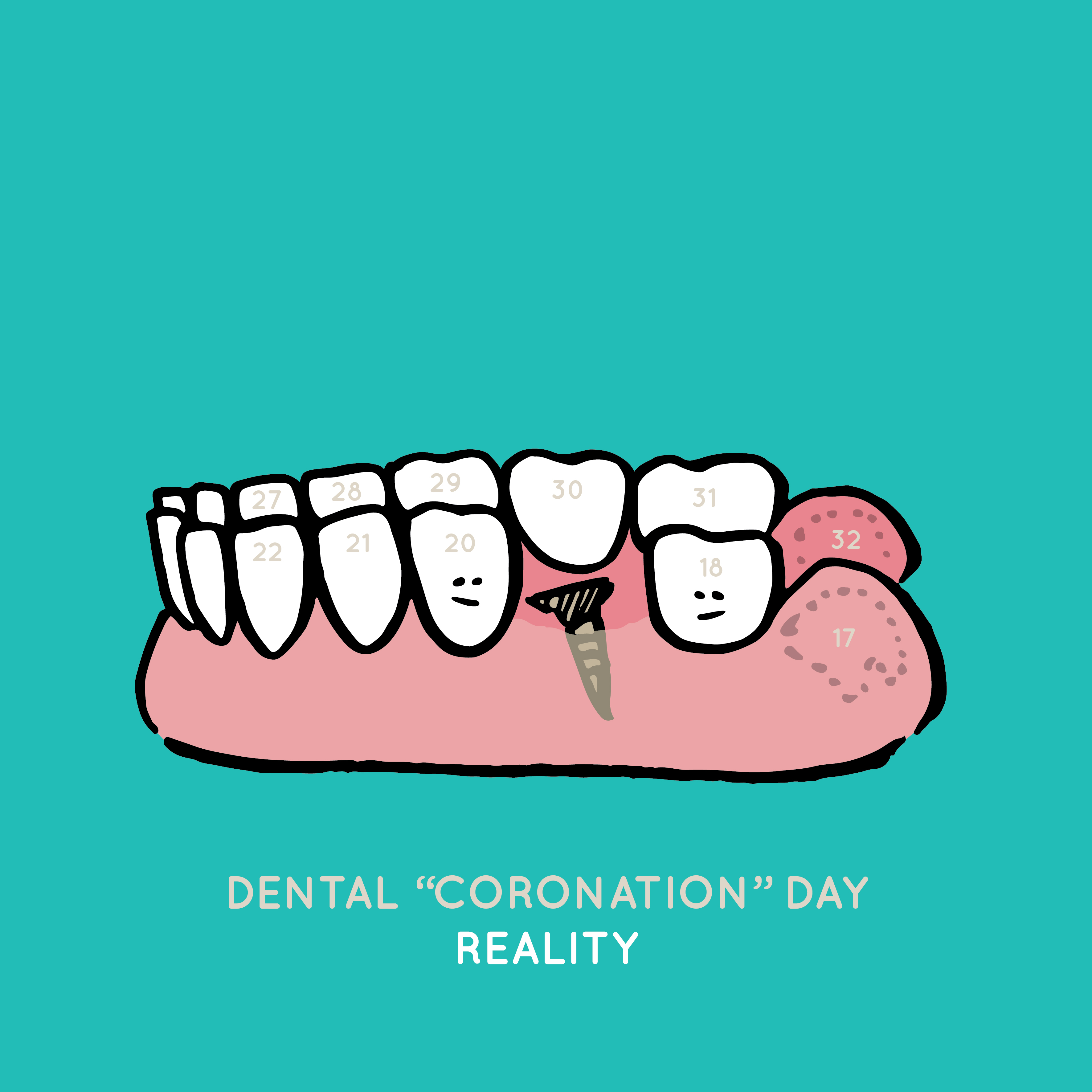 Dental “Coronation” Day: Expectation vs&nbsp;Reality