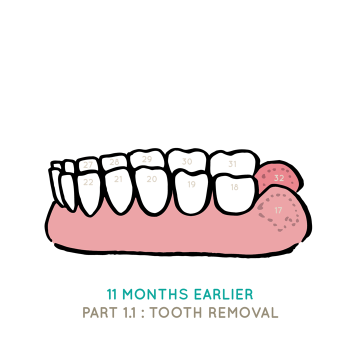 Dental journal: The long-awaited&nbsp;crown